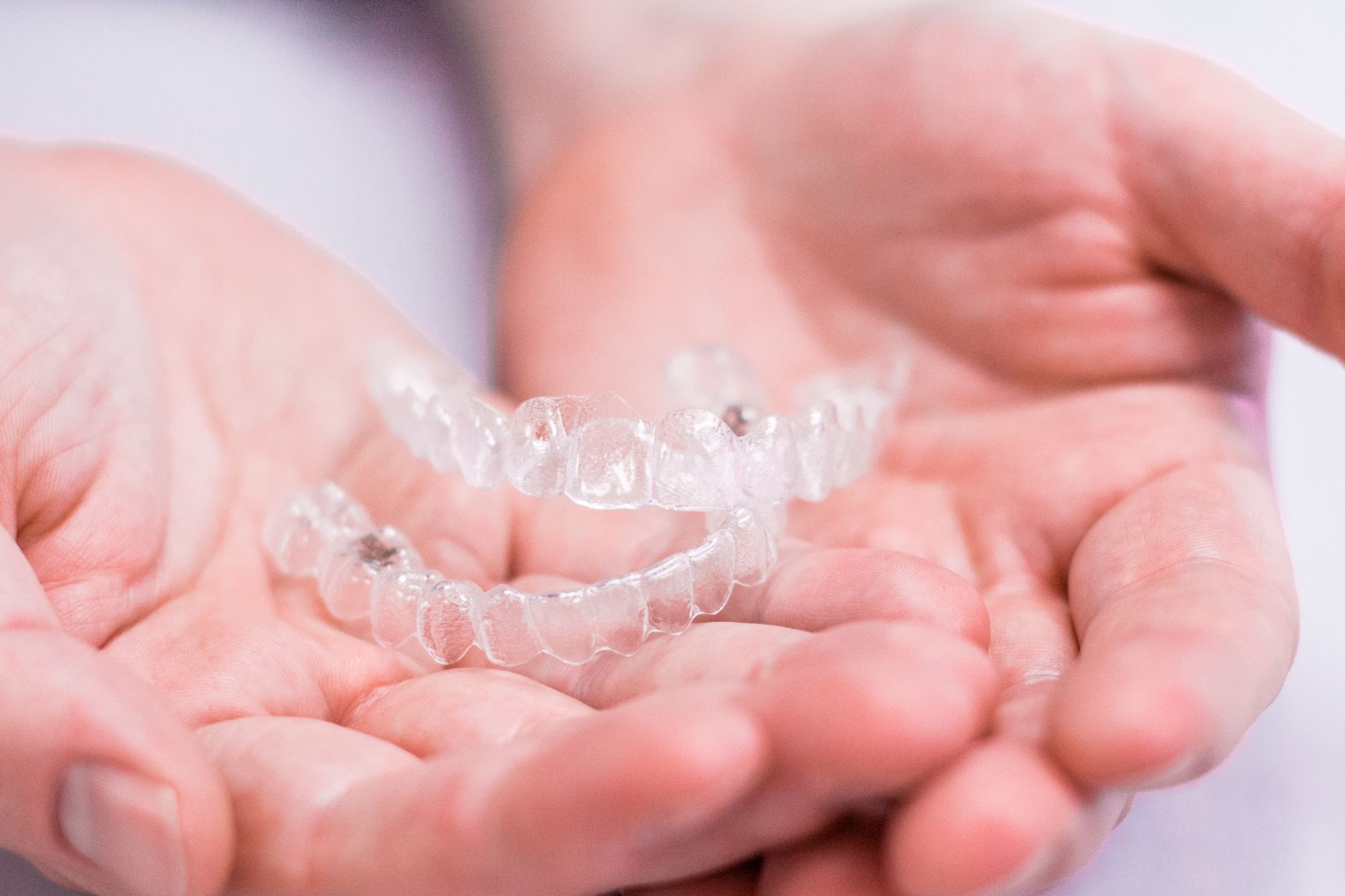 clear aligners